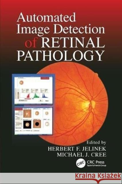 Automated Image Detection of Retinal Pathology Herbert Jelinek (Medical University of V Michael J. Cree (University of Waikato,   9781138114494 CRC Press - książka