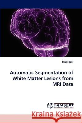 Automatic Segmentation of White Matter Lesions from MRI Data Shenshen 9783838376431 LAP Lambert Academic Publishing - książka