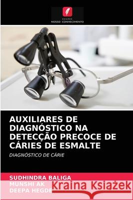 Auxiliares de Diagnóstico Na Detecção Precoce de Cáries de Esmalte Baliga, SUDHINDRA 9786202833400 Edicoes Nosso Conhecimento - książka