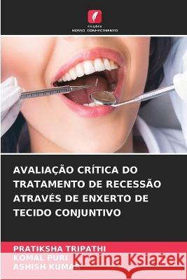 Avaliacao Critica Do Tratamento de Recessao Atraves de Enxerto de Tecido Conjuntivo Pratiksha Tripathi Komal Puri Ashish Kumar 9786205658239 Edicoes Nosso Conhecimento - książka