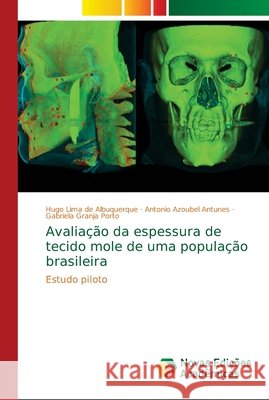 Avaliação da espessura de tecido mole de uma população brasileira Lima de Albuquerque, Hugo 9786139667093 Novas Edicioes Academicas - książka
