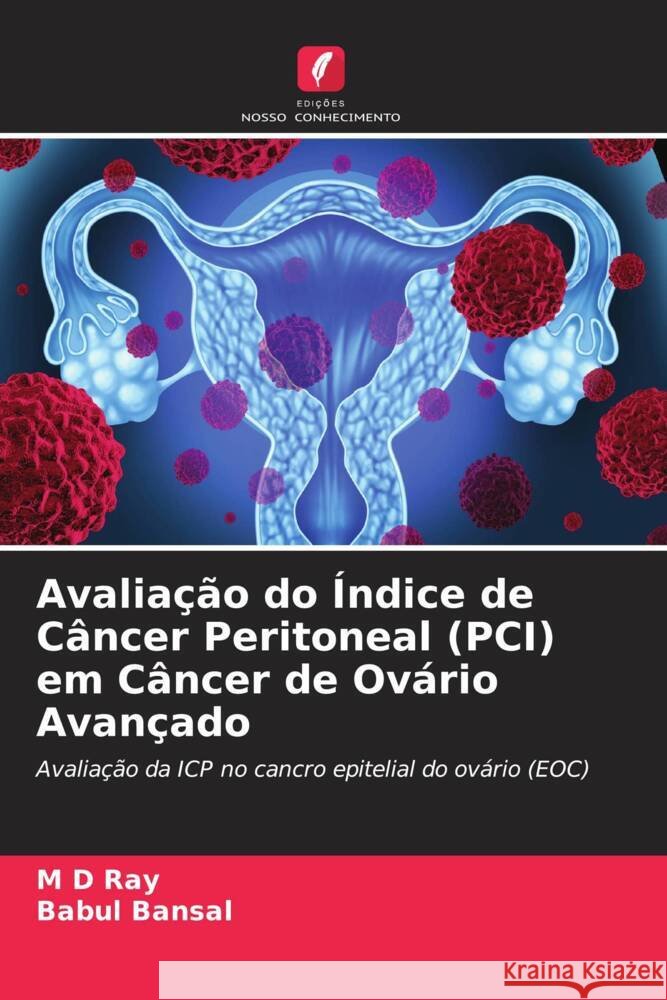 Avaliacao do Indice de Cancer Peritoneal (PCI) em Cancer de Ovario Avancado Ray, M D Babul Bansal  9786205885260 Edicoes Nosso Conhecimento - książka