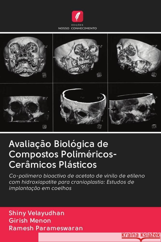 Avaliação Biológica de Compostos Poliméricos-Cerâmicos Plásticos Velayudhan, Shiny, Menon, Girish, Parameswaran, Ramesh 9786203044546 Edicoes Nosso Conhecimento - książka