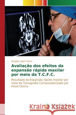 Avaliação dos efeitos da expansão rápida maxilar por meio da T.C.F.C. Lopes Flores Douglas 9783639757408 Novas Edicoes Academicas - książka