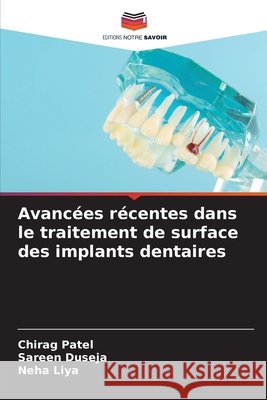 Avancées récentes dans le traitement de surface des implants dentaires Patel, Chirag, Duseja, Sareen, Liya, Neha 9786208752507 Editions Notre Savoir - książka