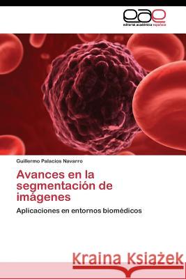 Avances en la segmentación de imágenes Palacios Navarro Guillermo 9783844342468 Editorial Academica Espanola - książka