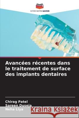 Avancées récentes dans le traitement de surface des implants dentaires Patel, Chirag, Duseja, Sareen, Liya, Neha 9786208752507 Editions Notre Savoir - książka
