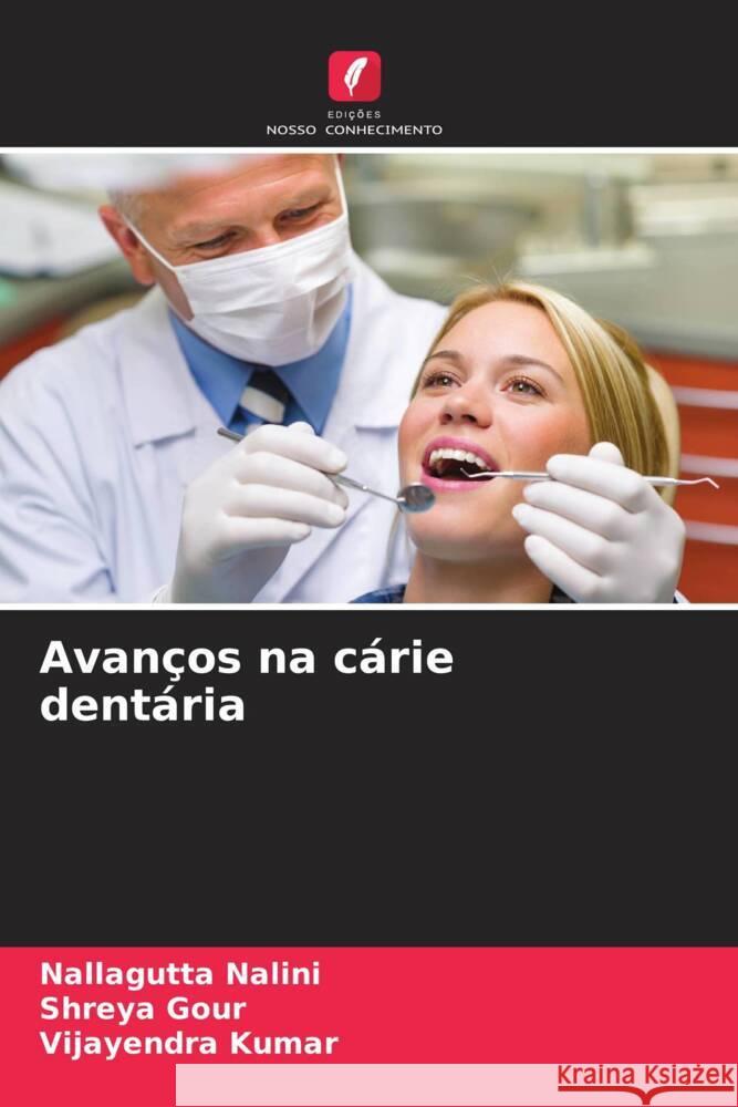 Avanços na cárie dentária Nalini, Nallagutta, Gour, Shreya, Kumar, Vijayendra 9786207091027 Edições Nosso Conhecimento - książka