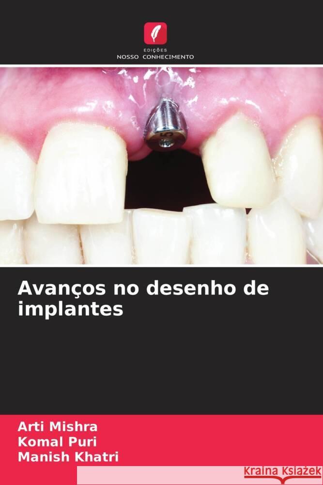 Avanços no desenho de implantes Mishra, Arti, Puri, Komal, Khatri, Manish 9786204709253 Edições Nosso Conhecimento - książka