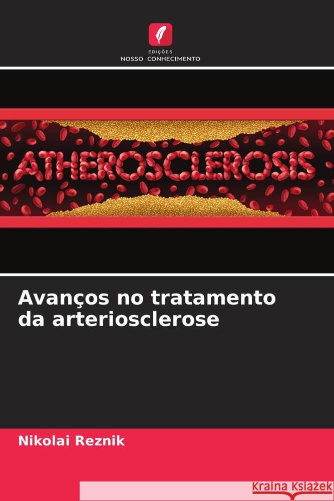 Avanços no tratamento da arteriosclerose Reznik, Nikolai 9786204530499 Edições Nosso Conhecimento - książka