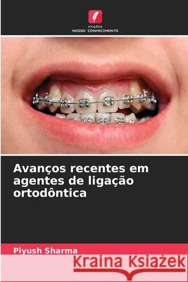 Avanços recentes em agentes de ligação ortodôntica Sharma, Piyush 9786209399978 Edições Nosso Conhecimento - książka