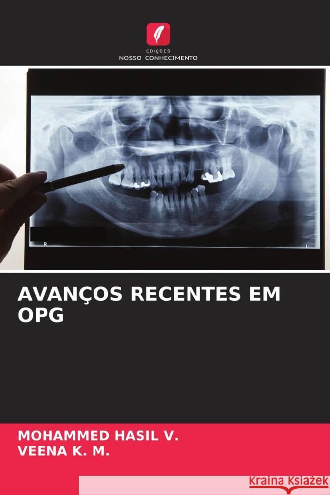 Avan?os Recentes Em Opg Mohammed Hasi Veena K 9786206605294 Edicoes Nosso Conhecimento - książka