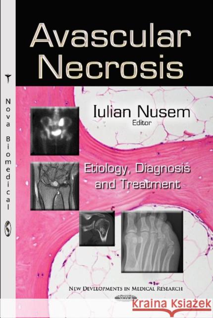 Avascular Necrosis: Etiology, Diagnosis & Treatment Iulian Nusem 9781629487380 Nova Science Publishers Inc - książka