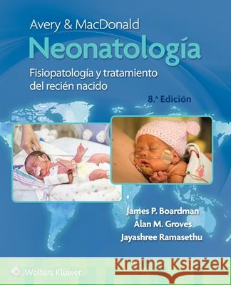 Avery Y Macdonald. Neonatología Boardman, James 9788418892110 LWW - książka