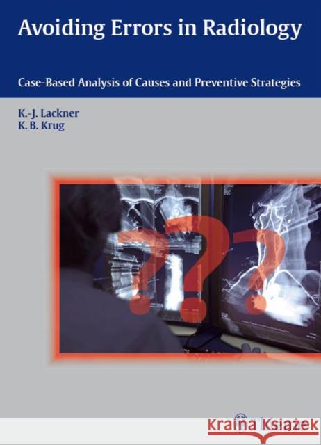 Avoiding Errors in Radiology: Case-Based Analysis of Causes and Preventive Strategies Krug, Kathrin Barbara 9783131538819 Thieme Medical Publishers - książka