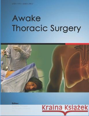 Awake Thoracic Surgery Eugenio Pompeo 9781608056514 Bentham Science Publishers - książka