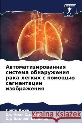 Awtomatizirowannaq sistema obnaruzheniq raka legkih s pomosch'ü segmentacii izobrazheniq Dzhun, Priti, Dzhatain, D-r Aman, Bhashkar, D-r Shalini 9786205966723 Sciencia Scripts - książka