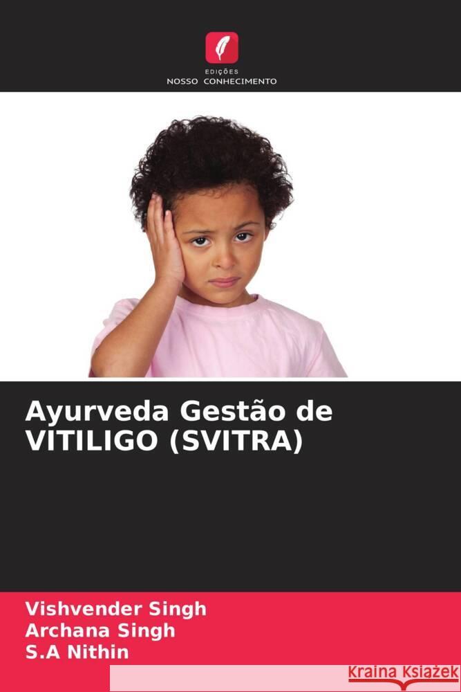 Ayurveda Gestão de VITILIGO (SVITRA) Singh, Vishvender, Singh, Archana, Nithin, S.A 9786204682143 Edições Nosso Conhecimento - książka