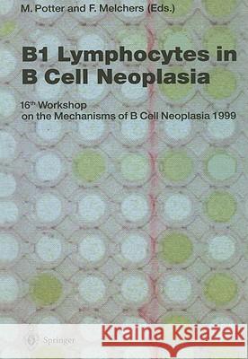 B1 Lymphocytes in B Cell Neoplasia: 16th Workshop on the Mechanisms of B Cell Neoplasia, 1999 Gerard Obrecht Lawrence W. Stark 9780306436598 Plenum Publishing Corporation - książka