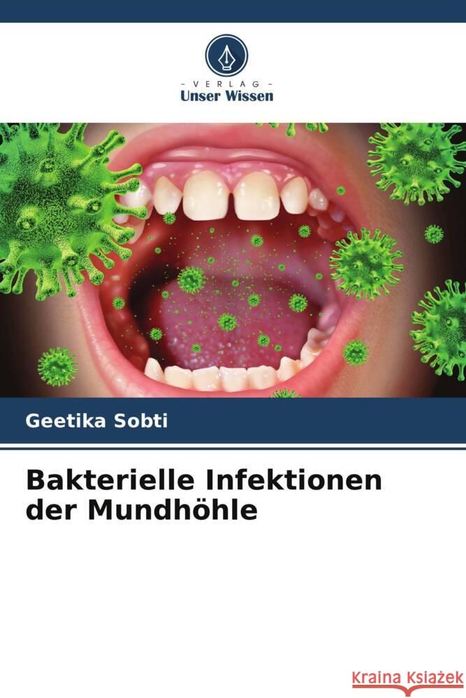 Bakterielle Infektionen der Mundhöhle Sobti, Geetika 9786205572412 Verlag Unser Wissen - książka