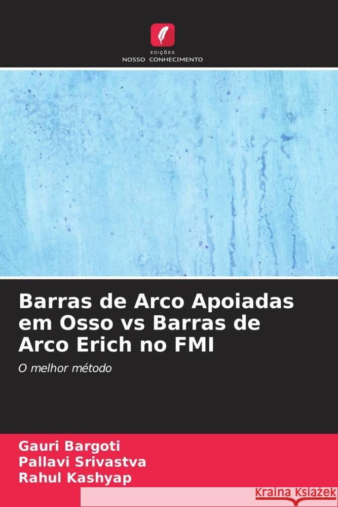 Barras de Arco Apoiadas em Osso vs Barras de Arco Erich no FMI Bargoti, Gauri, Srivastva, Pallavi, Kashyap, Rahul 9786204913780 Edições Nosso Conhecimento - książka