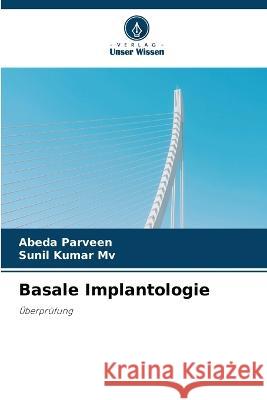 Basale Implantologie Abeda Parveen, Sunil Kumar Mv 9786205342534 Verlag Unser Wissen - książka