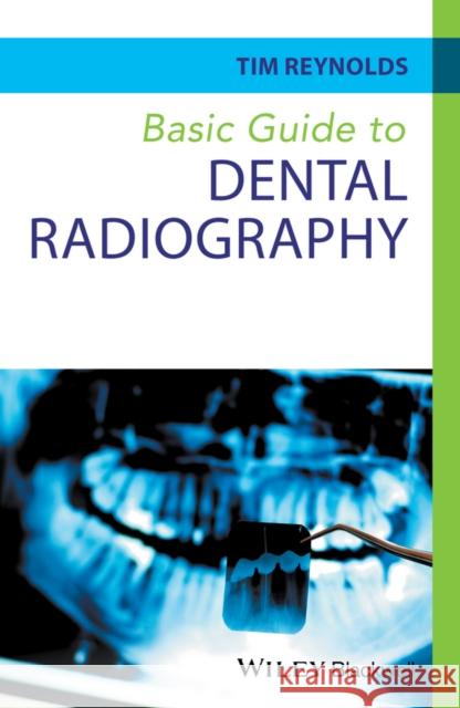 Basic Guide to Dental Radiography Reynolds, Tim 9780470673126 John Wiley & Sons - książka