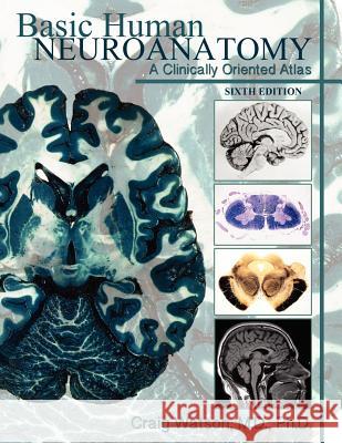 Basic Human Neuroanatomy: A Clinically Oriented Atlas Watson, Craig 9781105193637 Lulu.com - książka