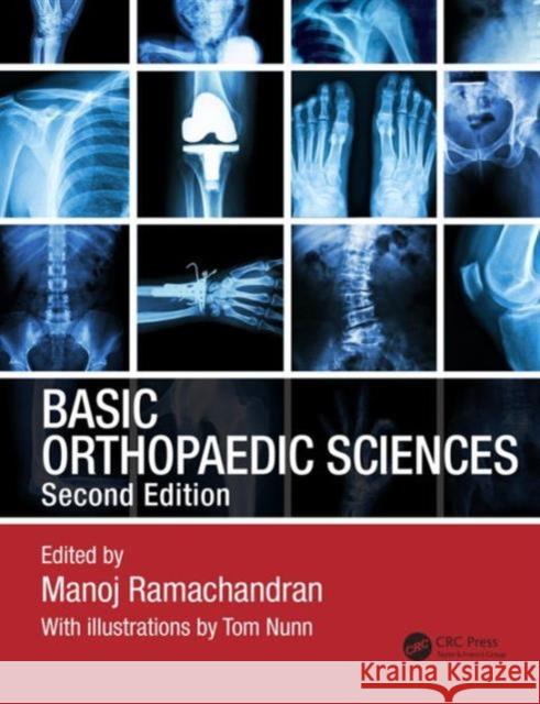 Basic Orthopaedic Sciences Manoj Ramachandran   9781444120981 Taylor & Francis Ltd - książka