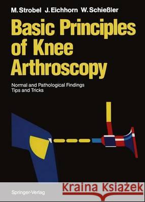 Basic Principles of Knee Arthroscopy: Normal and Pathological Findings Tips and Tricks Klein, Willemijn M. 9783642763311 Springer - książka