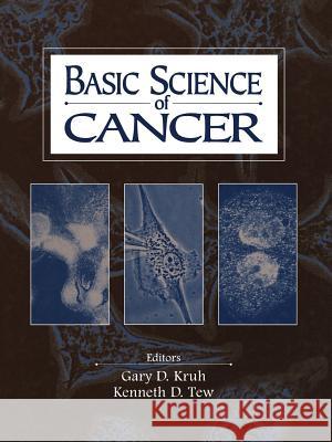 Basic Science of Cancer Gary D. Kruh Kenneth D. Tew 9781468484397 Current Medicine - książka