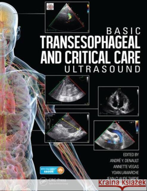 Basic Transesophageal and Critical Care Ultrasound Andre Denault Pierre Couture Yoan Lamarche 9781482237122 CRC Press - książka