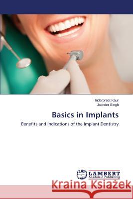 Basics in Implants Kaur Inderpreet 9783659685156 LAP Lambert Academic Publishing - książka