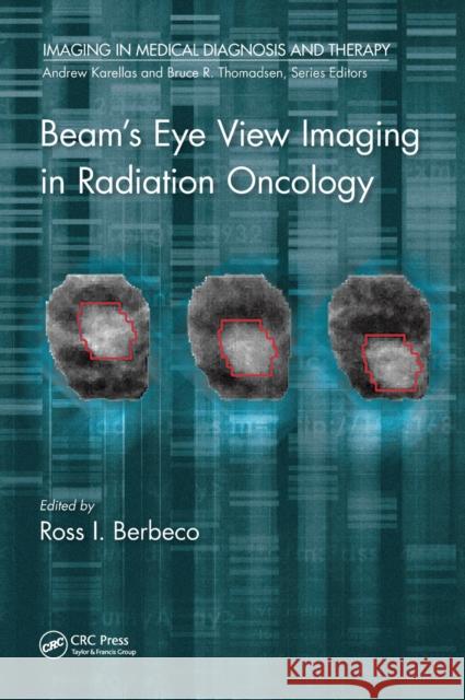 Beam's Eye View Imaging in Radiation Oncology Ross I. Berbec 9781498736343 CRC Press - książka