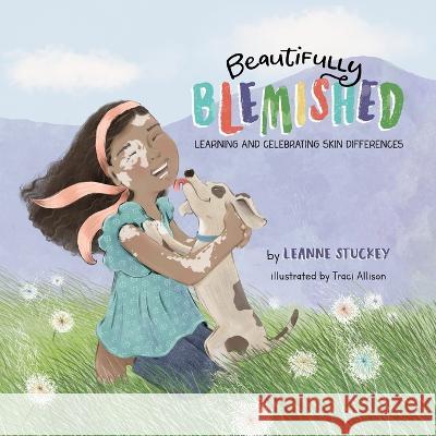 Beautifully Blemished: Learning and Celebrating Skin Differences Leanne Stuckey   9798985234503 Beautifully Blemished, LLC - książka