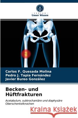 Becken- und Hüftfrakturen Carlos F Quesada Molina, Pedro J Tapia Fernández, Javier Bureo González 9786203641059 Verlag Unser Wissen - książka