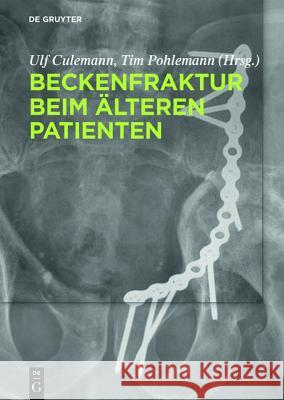 Beckenfraktur beim älteren Patienten Ulf Culemann Tim Pohlemann 9783110426489 de Gruyter - książka