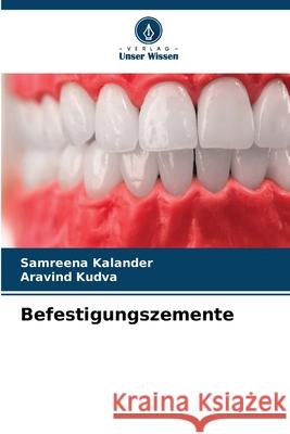 Befestigungszemente Kalander, Samreena, Kudva, Aravind 9786208685546 Verlag Unser Wissen - książka