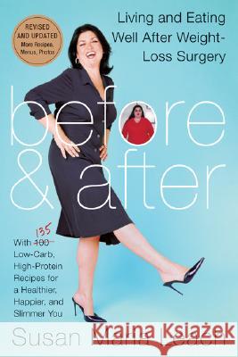 Before and After: Living and Eating Well After Weight-loss Surgery Susan Maria Leach 9780061242854 HarperCollins Publishers Inc - książka