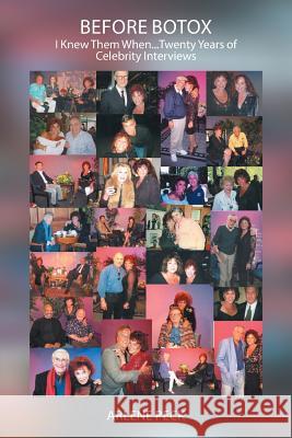 Before Botox: I Knew Them When...Twenty Years of Celebrity Interviews Arlene Peck 9781524557805 Xlibris - książka