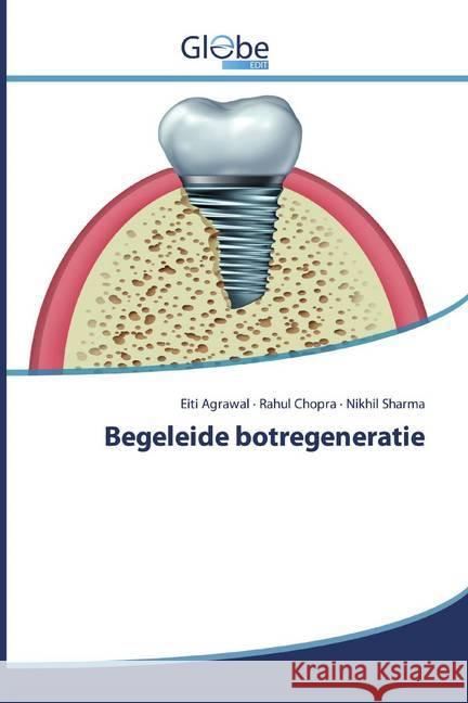 Begeleide botregeneratie Agrawal, Eiti; Chopra, Rahul; Sharma, Nikhil 9786200590879 GlobeEdit - książka