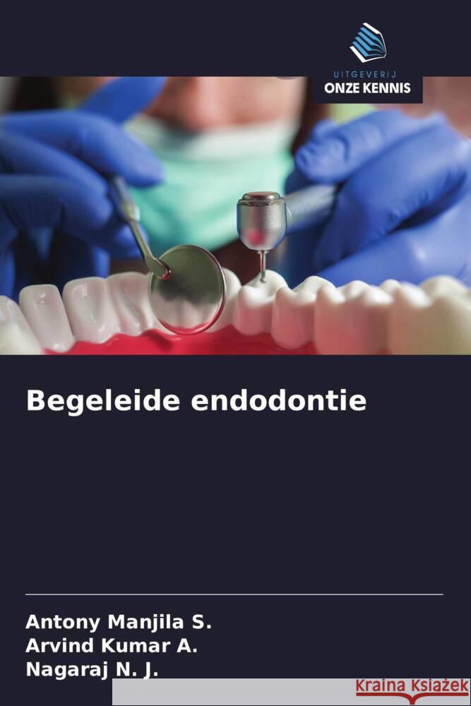 Begeleide endodontie Manjila S., Antony, A., Arvind Kumar, N. J., Nagaraj 9786208294878 Uitgeverij Onze Kennis - książka