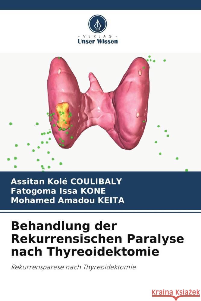 Behandlung der Rekurrensischen Paralyse nach Thyreoidektomie Assitan Kol? Coulibaly Fatogoma Issa Kone Mohamed Amadou Keita 9786208070465 Verlag Unser Wissen - książka