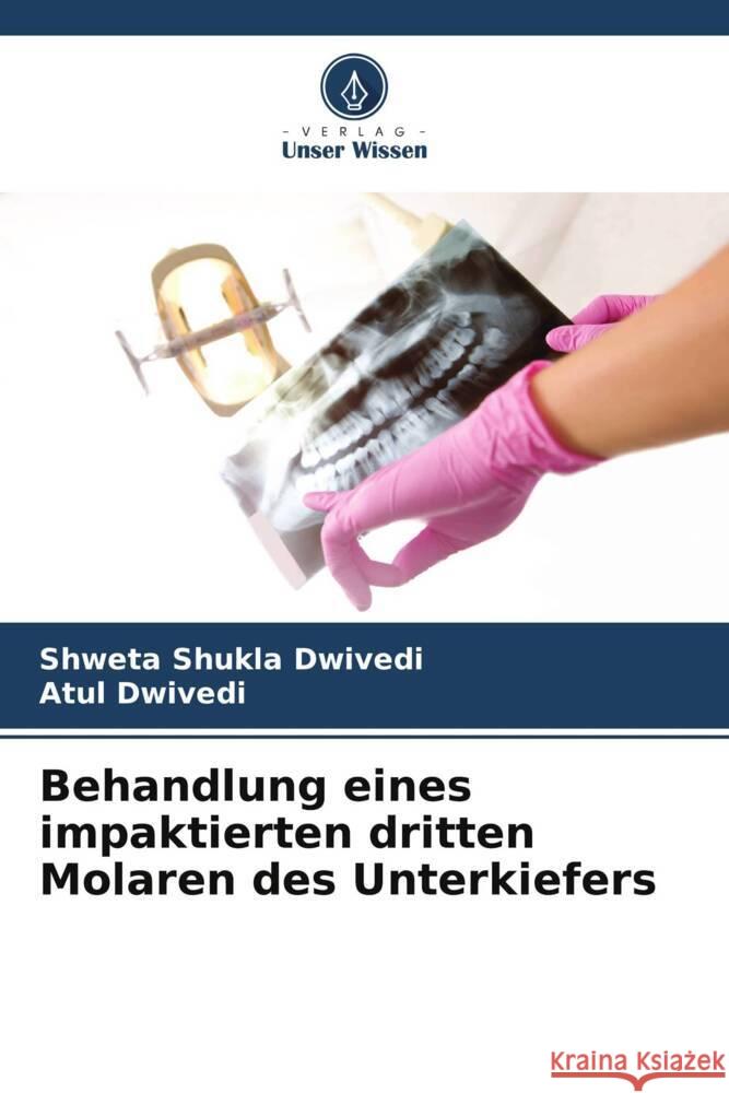 Behandlung eines impaktierten dritten Molaren des Unterkiefers Shweta Shukla Dwivedi, Atul Dwivedi 9786205281536 Verlag Unser Wissen - książka