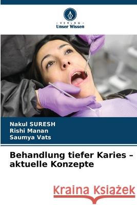 Behandlung tiefer Karies - aktuelle Konzepte Nakul Suresh Rishi Manan Saumya Vats 9786208880583 Verlag Unser Wissen - książka