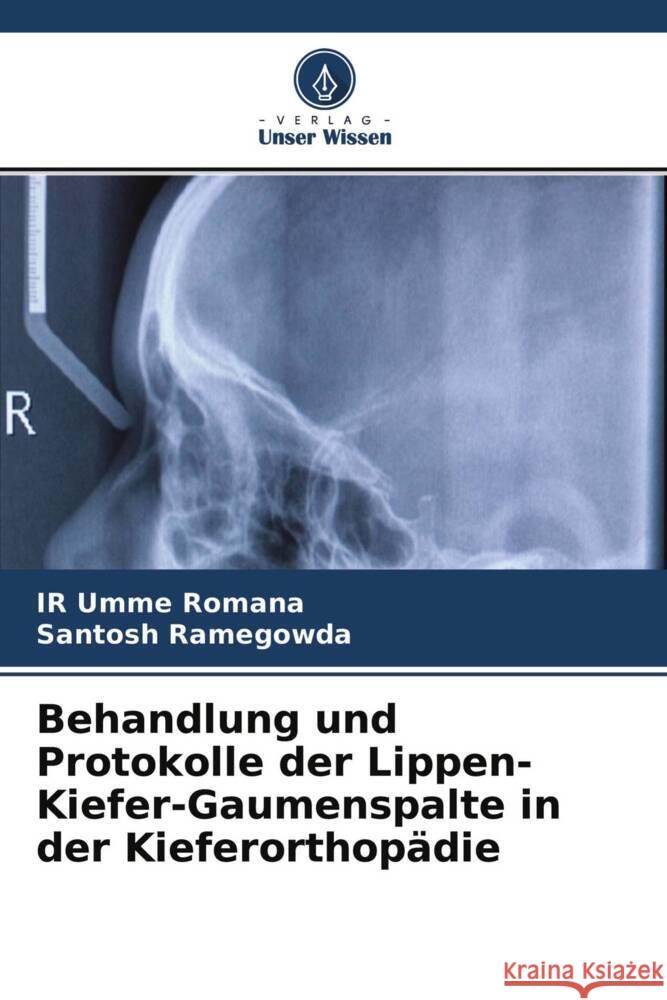 Behandlung und Protokolle der Lippen-Kiefer-Gaumenspalte in der Kieferorthopädie Romana, IR Umme, Ramegowda, Santosh 9786204419305 Verlag Unser Wissen - książka
