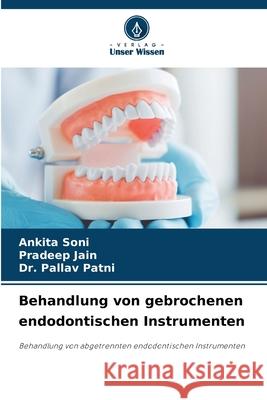 Behandlung von gebrochenen endodontischen Instrumenten Soni, Ankita, Jain, Pradeep, Patni, Dr. Pallav 9786202423465 Verlag Unser Wissen - książka