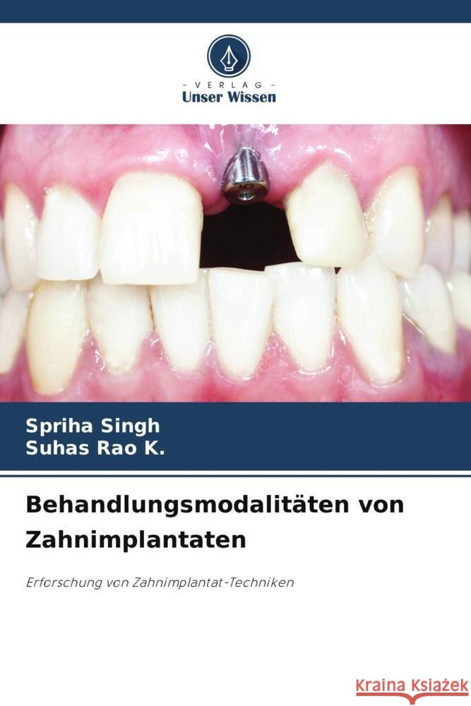 Behandlungsmodalit?ten von Zahnimplantaten Spriha Singh Suhas Rao K 9786208069346 Verlag Unser Wissen - książka