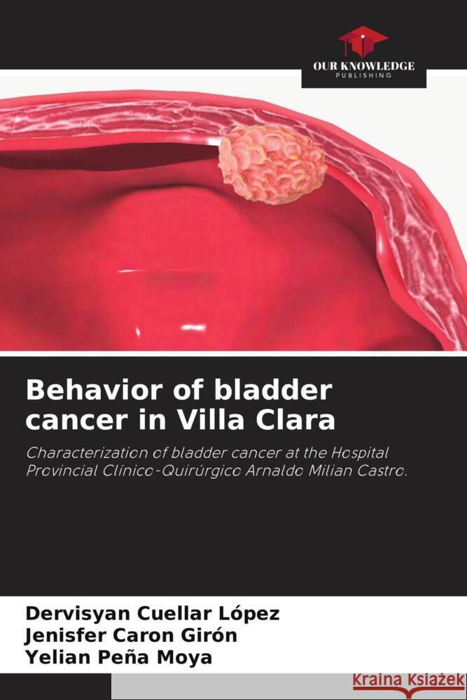 Behavior of bladder cancer in Villa Clara Dervisyan Cuella Jenisfer Caro Yelian Pe? 9786206865162 Our Knowledge Publishing - książka