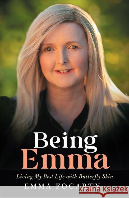 Being Emma: Living My Best Life with Butterfly Skin Emma Fogarty 9781785375682 Merrion Press - książka